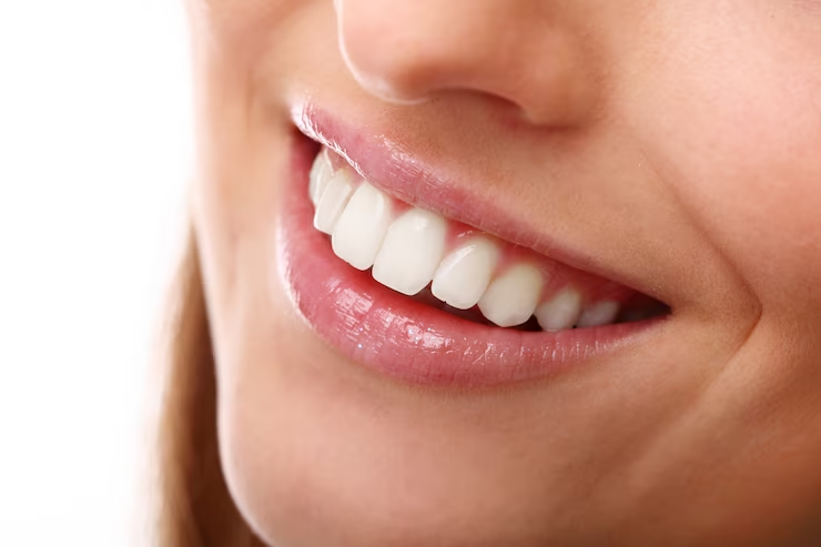 , 5 Reasons Why You Should Consider Teeth Whitening!