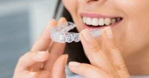 Invisalign
