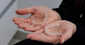 Invisalign