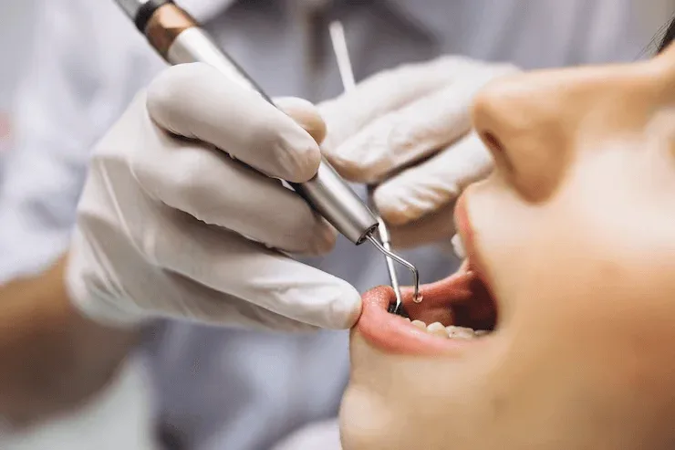 Dental implant surgery