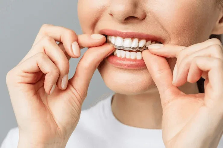 Dentist in Bangalore for Dental Bridge