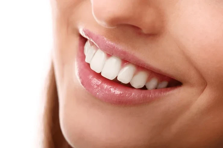 5 Reasons to consider teeth whitening