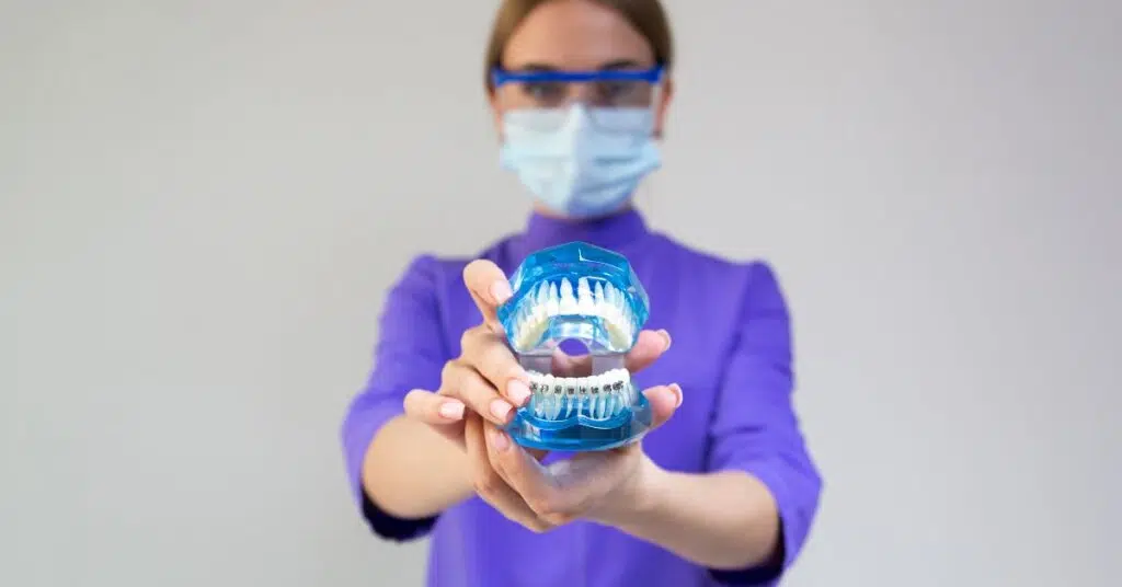 Dental Crowns and Bridges