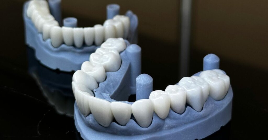 Dental Crowns and Bridges