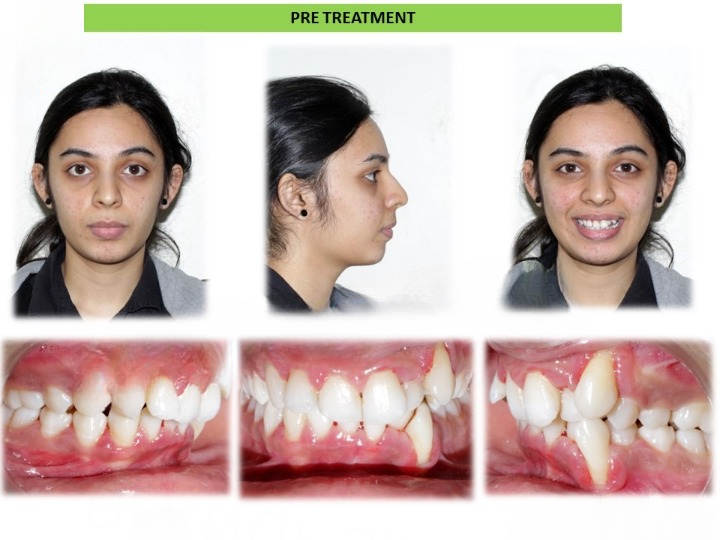 Pre and post comparison 10