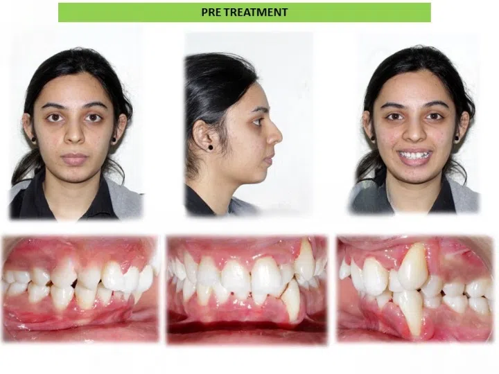 Pre and post comparison 10