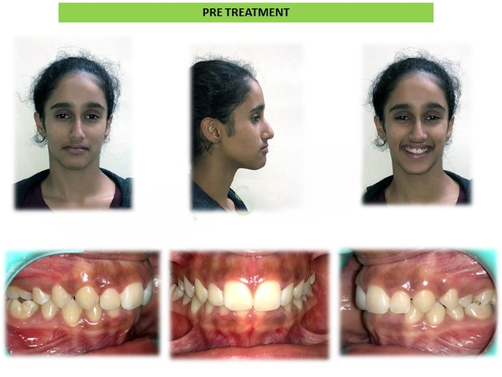 Pre and post comparison