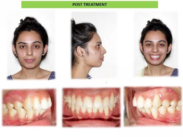 Pre and post comparison 6