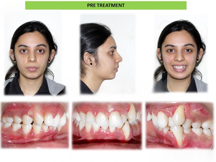 Pre and post comparison 7