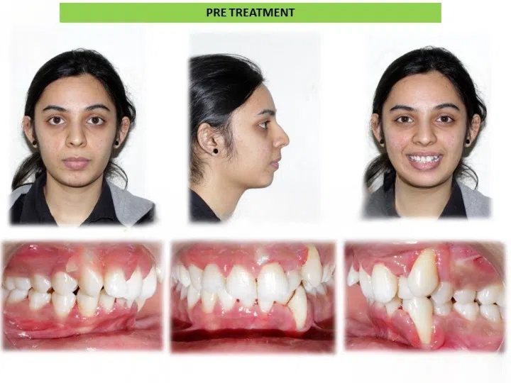 Pre and post comparison 7