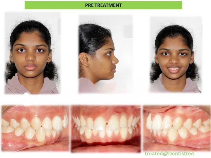 Pre and post comparison 8