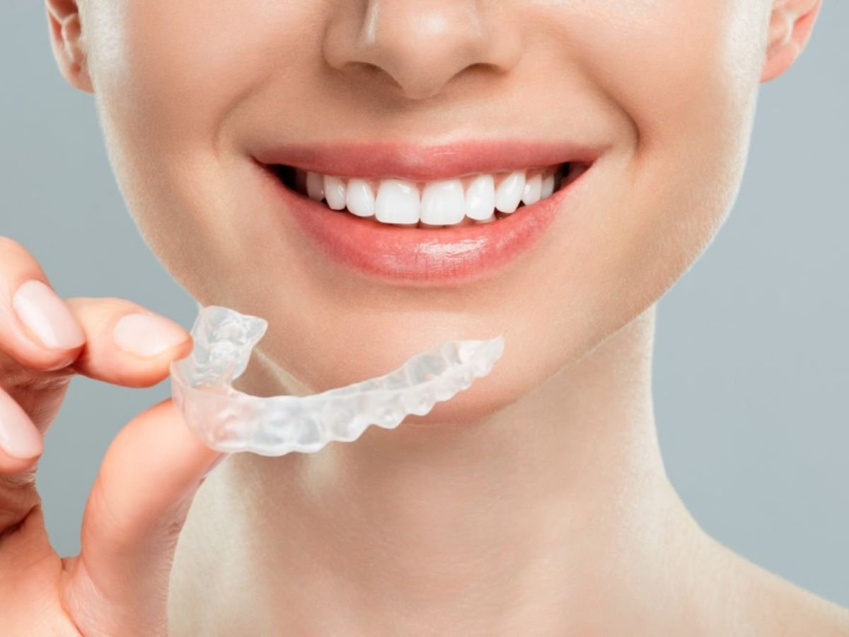 Invisalign in Bangalore