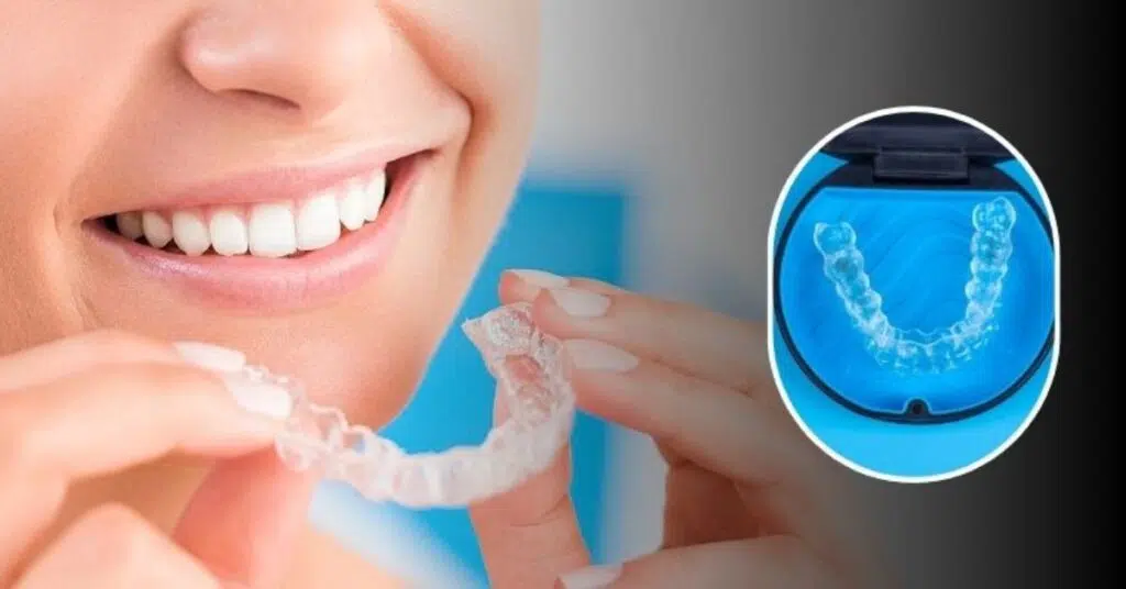 How Do Dentists Plan Invisalign Treatment