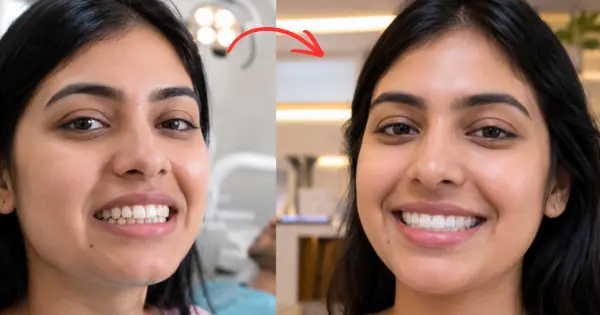 Can Invisalign for Overbite and Crossbite Work?
