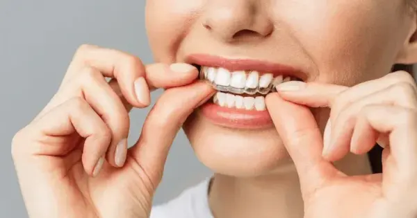 Invisalign Near JP Nagar