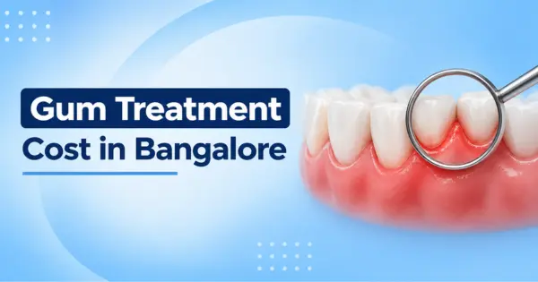 Gum Treatment Cost in Bangalore