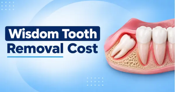 Wisdom Tooth Removal Cost in Bangalore