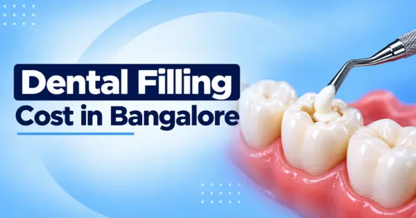 Dental Filling Cost in Bangalore
